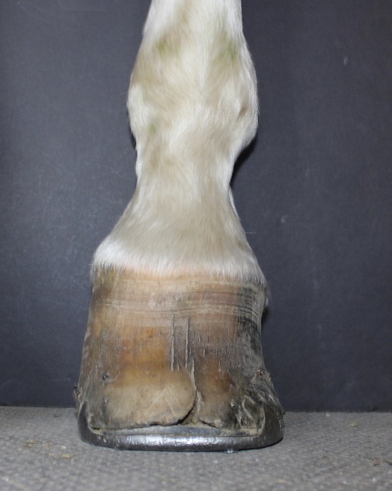 This club foot also has a significant rotational deformity which is exacerbated by the length.